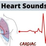Hypertension |  Hypotension | Cardiac output